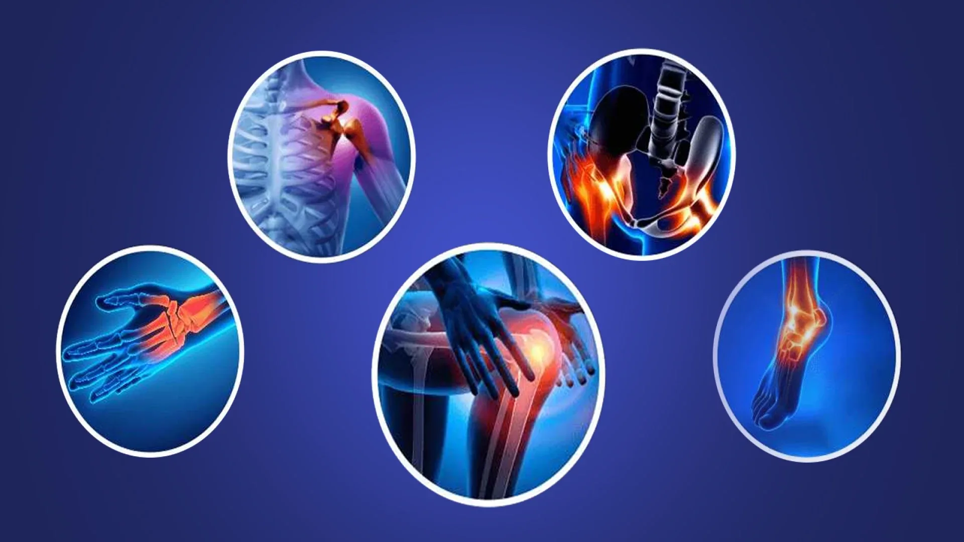 Orthopedi